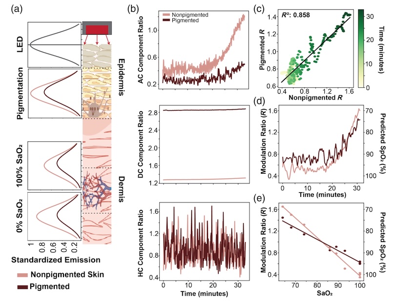 Research confirms that skin pigmentation can reduce the accuracy of pulse oximeters. Researchers found that red light, a key component in pulse oximetry, is more strongly attenuated in pigmented skin. Credit: UNC/SPIE Biophotonics Discovery.