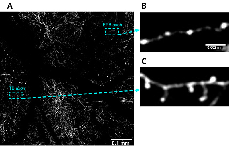 Two-photon microscopy captures axonal segments in a living brain, enabling researchers to quantify structural changes in specialized areas under noninvasive low-intensity repetitive transcranial magnetic stimulation (rTMS). A zoomed-out survey of the brain area (A) shows complex networks of neurons, visible via fluorescent marker. Insets (B and C) show specialized axonal endings (termed 