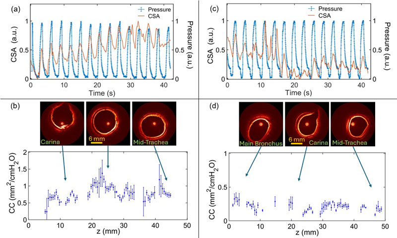 High-resolution anatomical OCT scans from two different live animals demonstrate accurate mapping of airway wall compliance (CC) along the upper airway. Credit: S. J. Soundararajan et al., doi 10.1117/1.JBO.30.12.124502.