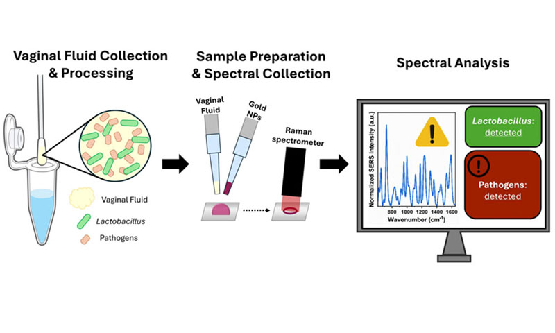 Surface-enhanced Raman spectroscopy (SERS) captures the spectra of vaginal fluid samples to detect biochemical changes in relation to bacterial presence. By determining the presence of specific bacterial species, SERS can help overcome the limitations of current clinical diagnostic techniques. Image courtesy of A. Rourke-Funderburg, Vanderbilt Biophotonics Center.