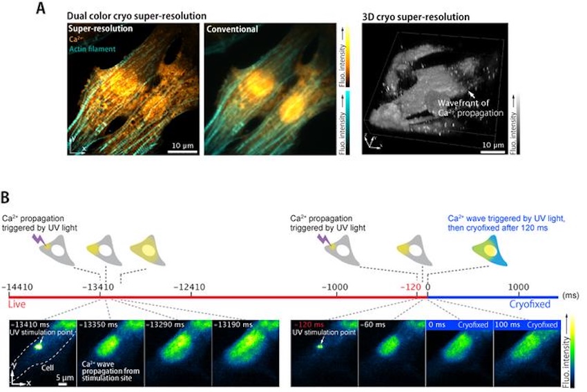 (A) Cryogenic dual color super-resolution imaging of calcium ion distributions and actin filaments in neonatal rat cardiomyocytes and super-resolution three-dimensional view of calcium ion distribution. (B) Time-deterministic cryofixation of intracellular calcium ion wave propagation after UV laser stimulation. Credit: University of Osaka/Light Science & Applications.