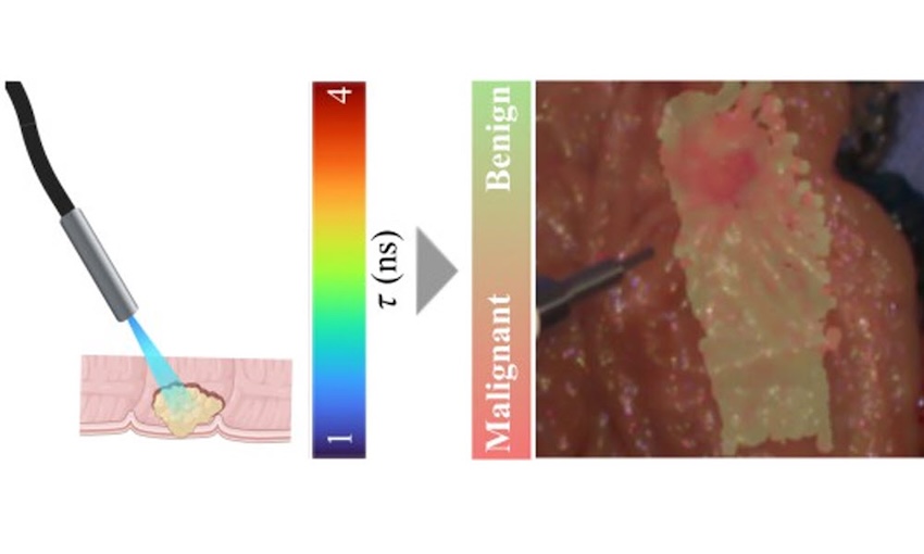 Optical imaging with autofluorescence measurements identifies cancerous tissues with high reliability. Credit: J. Lagarto/Champalimaud Foundation. 