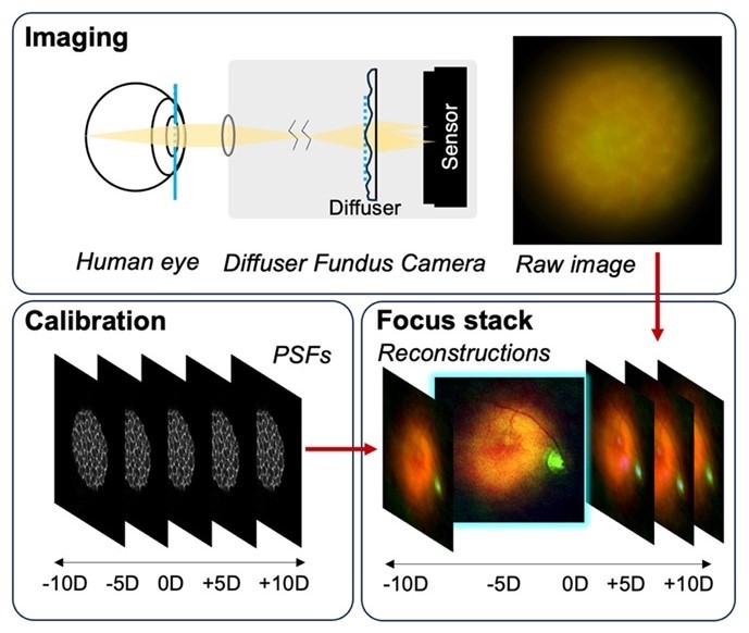 The imaging system uses a special diffuser that captures 3D light information from the retina during imaging. With this data, computer software can reconstruct and refocus images after they are taken. The system offers a simpler, lower-cost tool for screening and diagnosis. Image courtesy of C. Simmerer (Johns Hopkins University). 