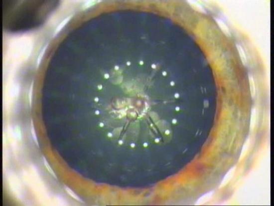 Using an ultrafast laser for lens fragmentation provides better cutting precision and improves the geometric accuracy of the procedure. Credit: Technolas PV. 