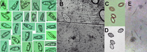(A) Individual Schistosoma mansoni eggs in stool sample from experimentally infected mouse from sensor of a mobile phone (Sony-Ericsson C905). In (B) S. mansoni eggs are seen by an ordinary microscope using 20xobjective (Leica DMRB with AxioCam digital camera). Trichuris trichiura eggs are seen in images obtained on-chip (C) and by conventional microscope (D) using 10xobjective. On-chip images were obtained with S. mansoni. Strongyloides larvae (E) by on-chip imaging using a webcam sensor (Live! Cam Sync, Creative Labs).