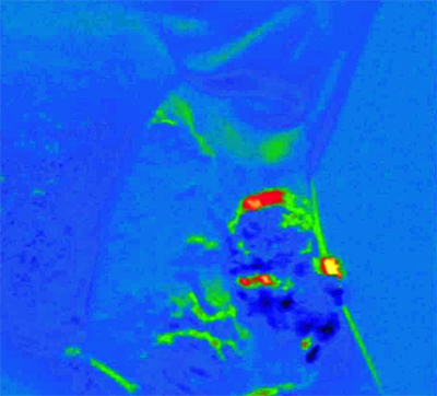 The set-up generates a pseudo colour map: blue designates healthy tissue, red denotes pre-malignant tissue and yellow identifies malignant tissue.