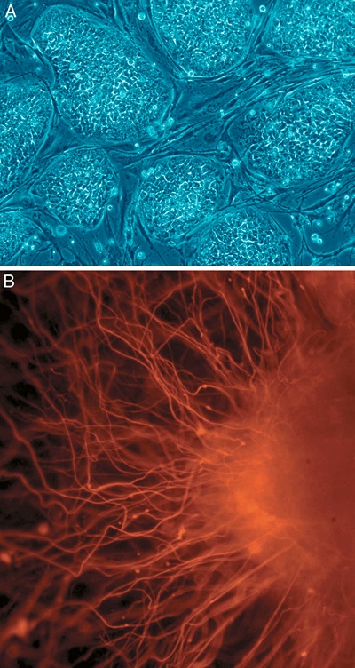 Top image (A) shows human embryonic stem cells, while image 
(B) below shows neurons derived from those cells. The autofluorescence technique described by Ewa Goldys appears welll suited to the characterization of different cell types. Images: Nissim Benvenisty, source:
<a target=