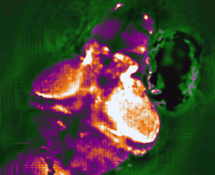 Head and majority of the brain of a zebrafish larva, as recorded and reconstructed using the light-field microscope. Parts of the brain showing pronounced neuronal activity are artificially colored in magenta to white, proportional to the strength of the activity.