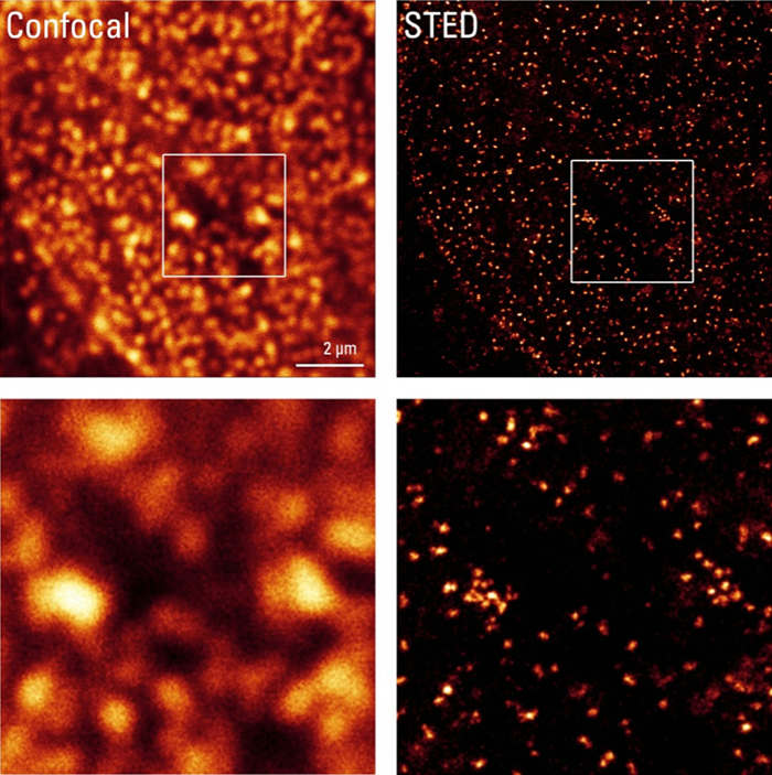 Finer detail: Immunostained nuclear pore complexes in HeLa cells (NUP153-ATTO 647N) illustrate the resolution enhancement achieved with Leica TCS SP8 STED 3X and the 775nm pulsed STED laser (right images) compared to the resolution achieved with confocal microscopy. Image: Leica Microsystems. 