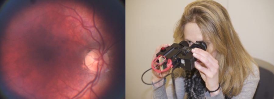 eyeSelfie in use, taking a high-quality self-aligned retina photograph. Credit: Camera Culture Group MIT Media Lab 