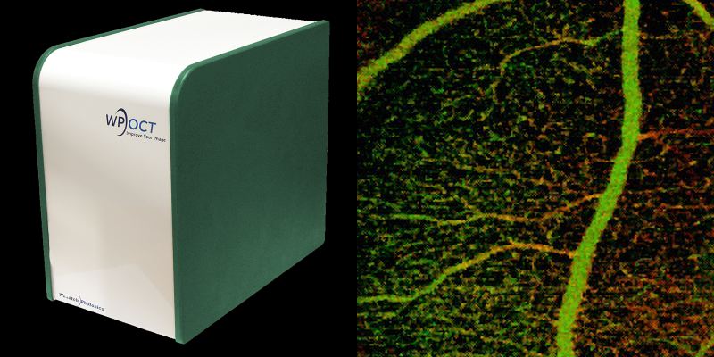 The MicroAngio system, and microvessels imaged by OCT angiography in mice retina. Wasatch Photonics has designed the platform to suit a broad range of non-ophthalmology applications too. Credit: Wasatch Photonics.