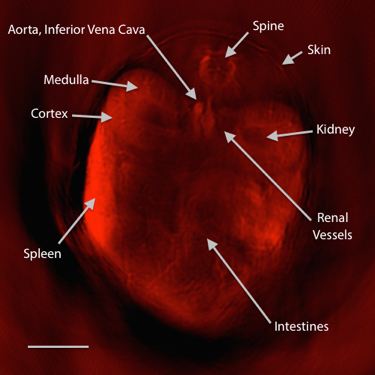 Blood hemoglobin oxygenation image acquired using multi-spectral optoacoustic tomography (MSOT), an emerging tool for clinical imaging that is low cost and does not require injected contrast. Scale bar = 5 mm. Credit: Sarah Bohndiek/Vision Laboratory (unpublished data).