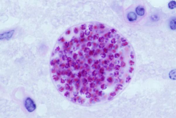 The new method could lead to better views of T. gondii, the cause of toxoplasmosis, as well as other biological materials. Credit: Jitender P. Dubey/Wikipedia.