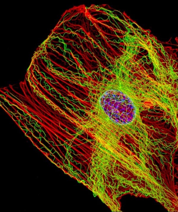 Actin filaments (shown in red) inside a fibroblast - a type of cell found commonly in connective tissue. Inside cells, actin fibers act like muscles to create tension, while so-called microtubules (shown in green) act like bones to withstand compression. Credit: James J. Faust and David G. Capco, Arizona State University/US National Institute of General Medical Sciences.