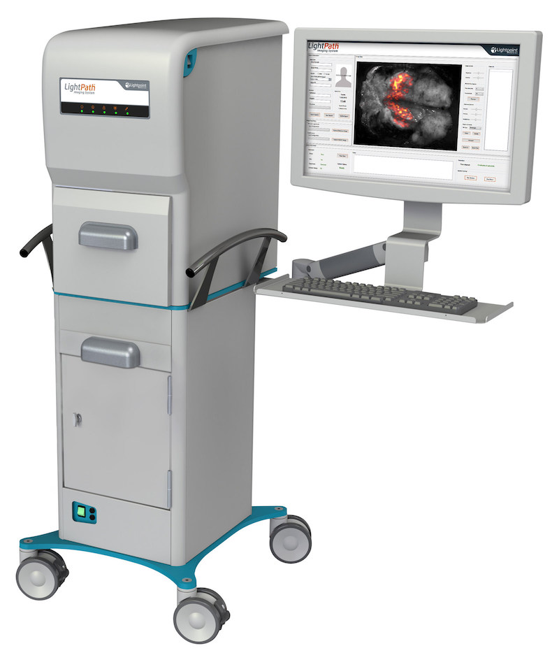 LightPath molecular imaging could help clinicians identify prostate cancers more effectively. Credit: Lightpoint Medical.