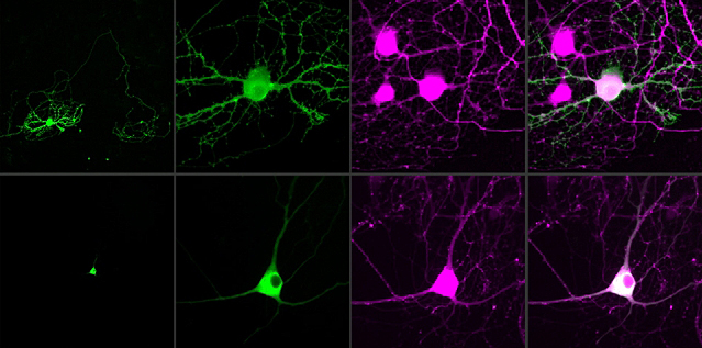 MIT researchers have devised a way to control single neurons using optogenetics. Image courtesy of the researchers.