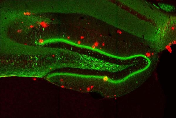 Captured by researchers at the RIKEN-MIT Center for Neural Circuit Genetics, the red sections in this image indicate severe amyloid plaque formation in the brain of a 9-month-old mouse with Alzheimer's disease. In humans, positron emission tomography (PET) scans are used to detect brain plaques, but an optical alternative that can access retinal plaques through the eye could offer major advantages. Image: RIKEN.
