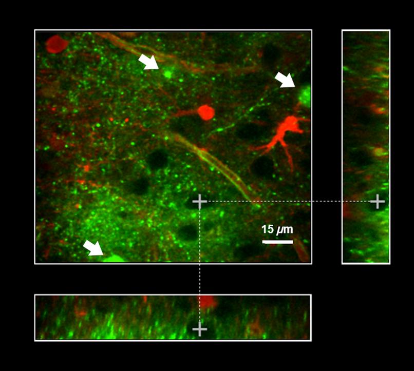 Fluorescence of the potassium nanosensor (green) after multiple injections into the ECS as measured by two-photon microscopy in a mouse acute brain slice. Arrows indicate the microinjection sites. Credit: University of Lausanne/SPIE Press Room.