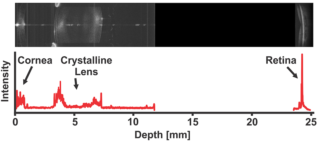 A composite image of the whole eye using the new OCT platform, with corresponding light intensity profile. Credit: Ireneusz Grulkowski/Pablo Artal/Optica.