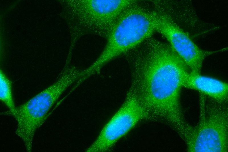 Single-molecule microscopy utilizing one of Photometrics