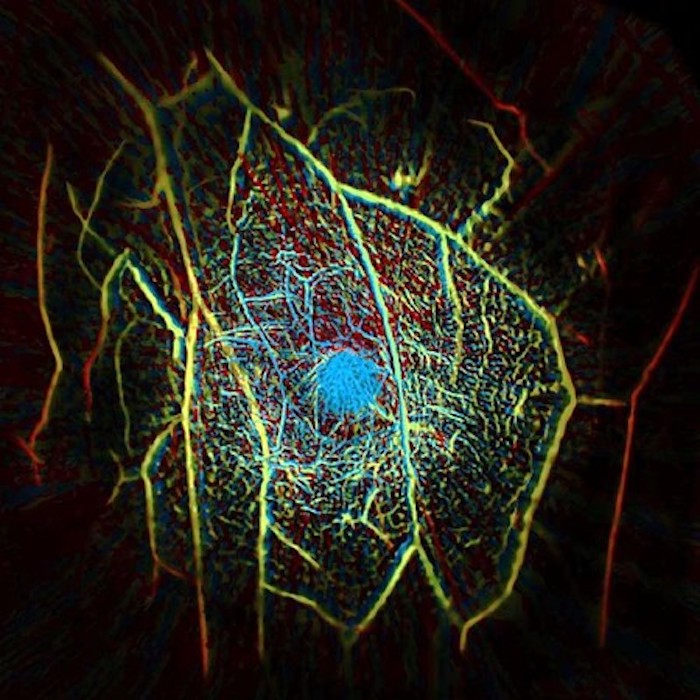 An image of the internal vascular structure of a human breast, created with a new scanner designed at Caltech. Credit: Caltech.