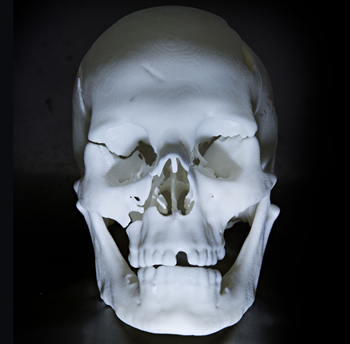 Sticky end: The laser generated skull clearly revealed a number of the significant injuries that Richard III had sustained in battle. Photo: Andrew Weekes Photography.