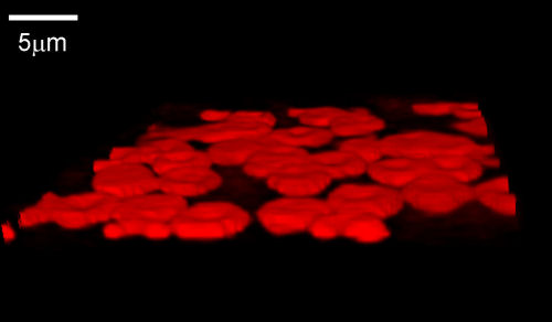seeing red cells