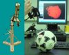 Tripod based hand-held 3D laser scanner