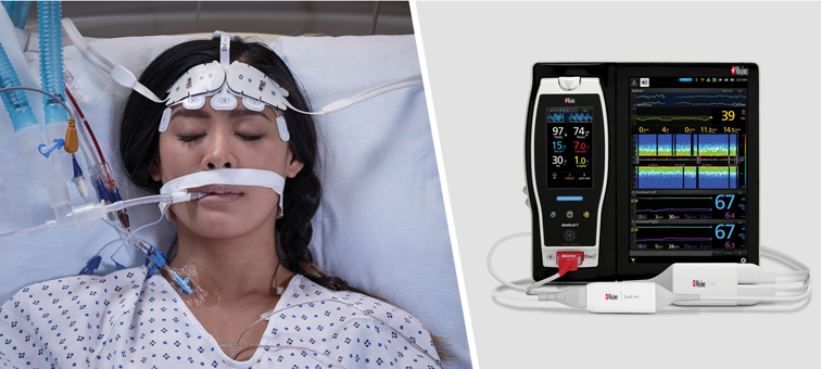 Masimo Root with O3 Regional Oximetry and SedLine Brain Function Monitor.