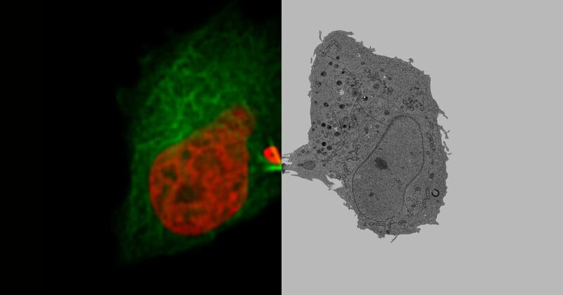 Images from Leica Microsystems' Live-Cell CLEM workflow. Click for info.