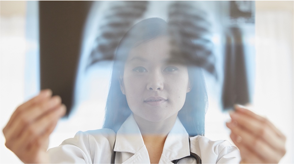 Lung cancer screening: Cellvizio assist diagnosis