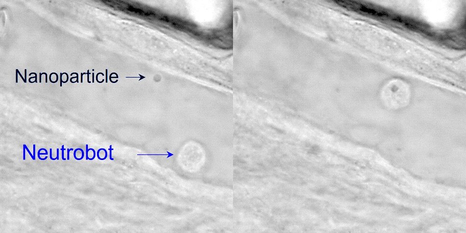 Collection and delivery: light-controlled neutrophil