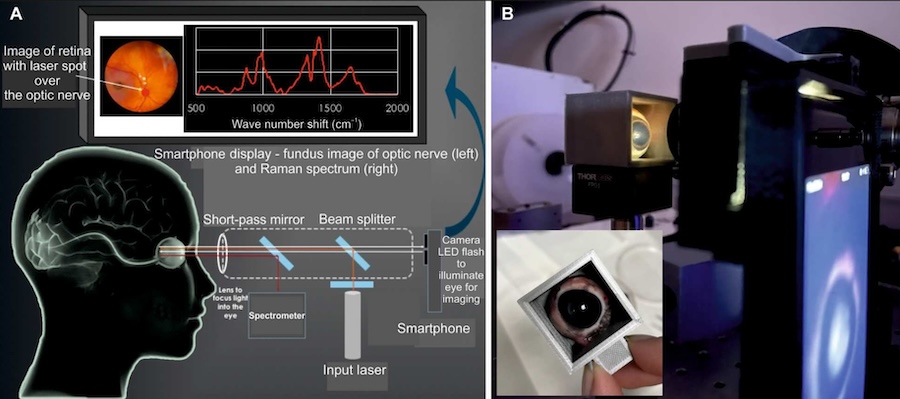 Window on the brain: biomarkers identified