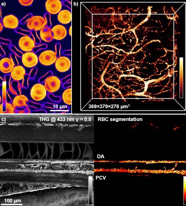 Higher order: new imaging for cells