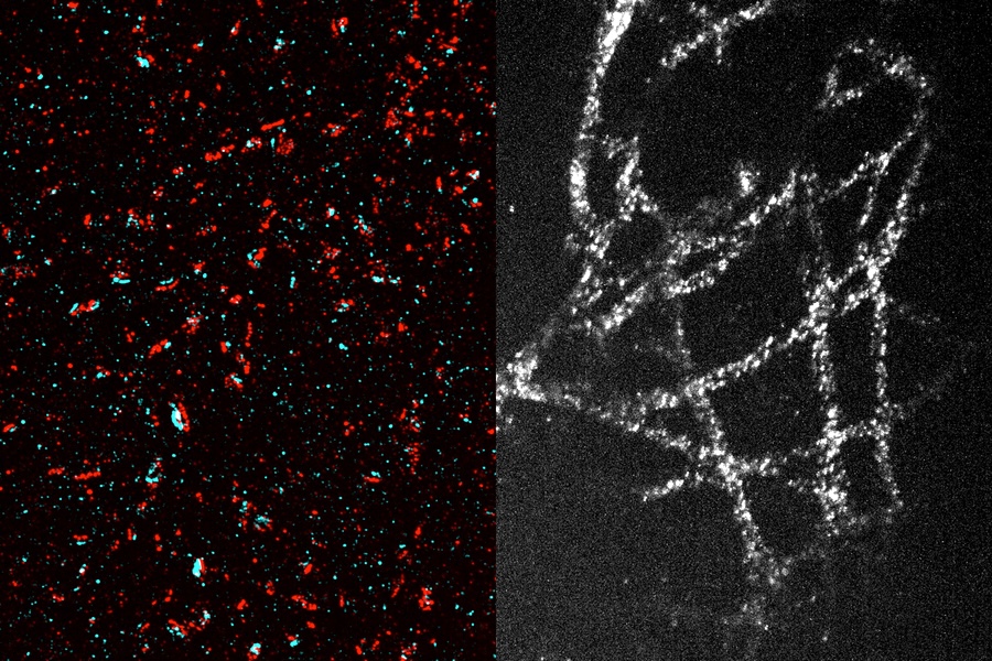 Separated and visible: cellular structure