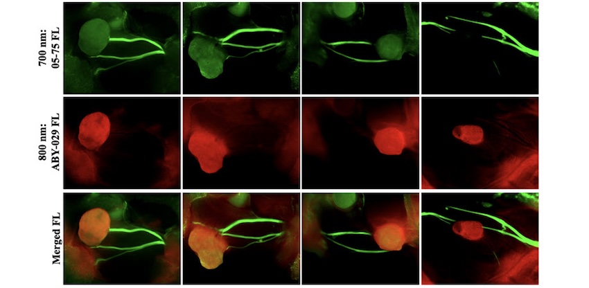 Visible difference: tissue types