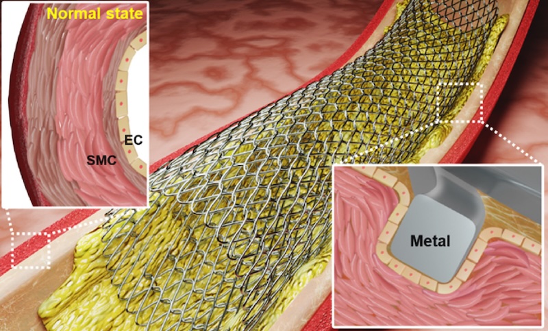 Test pattern: stent surfaces