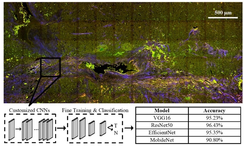 Multiphoton microscopy and deep learning: tumor detection Multiphoton microscopy and deep learning: tumor detection