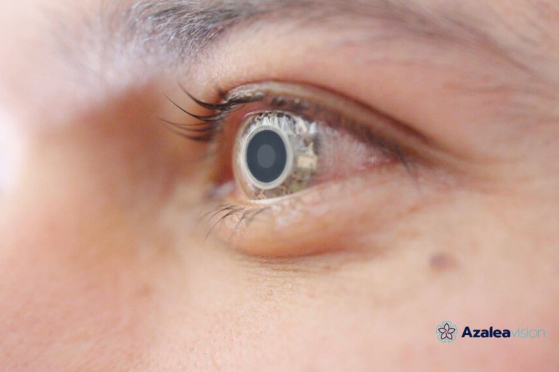 Smart vision correction