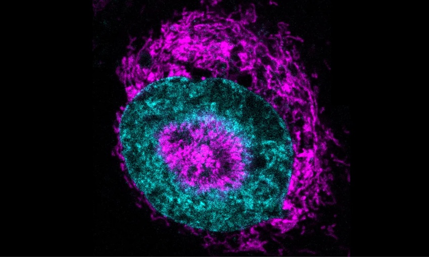 Cause and effect: mitochondria movement