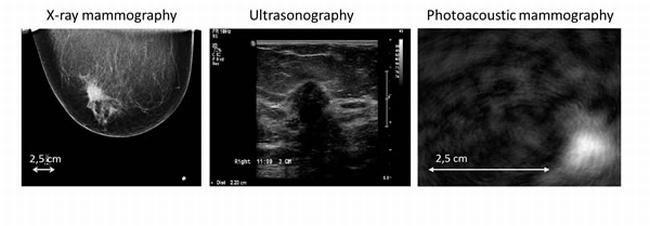 Photoacoustic scan