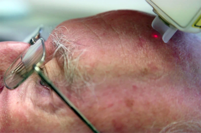 First clinical application is for the diagnosis of non-melanoma skin cancer.