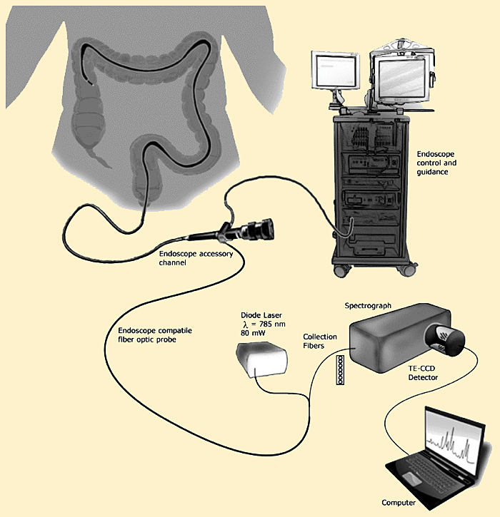 Improved diagnosis: Integrated Raman and endoscope instrumentation for in vivo subject measurement.