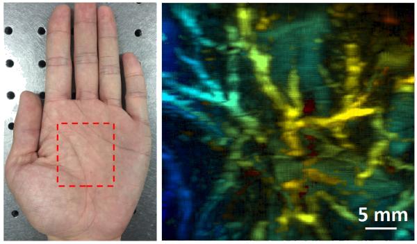 Skin deeper: imaging of tissues