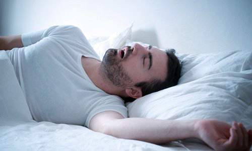 Sleep apnea affects millions worldwide.