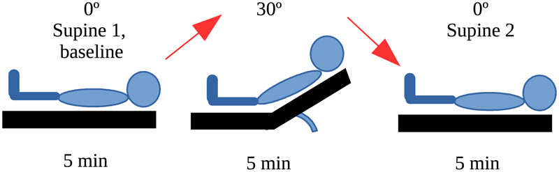 Protocol of the different head-of-bed position changes. (Click for more information)