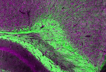 Mouse brain slices: UV and IR in combination