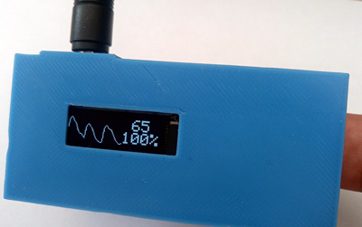 Do try this at home: Bath University's “Open Oximeter” sensor.