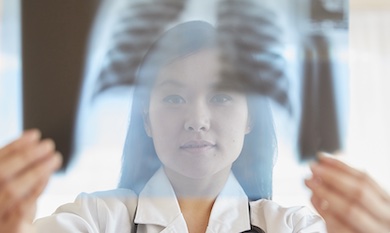 Lung cancer screening: Cellvizio assist diagnosis