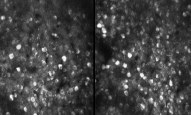 Large cell populations: MINI2P imaging